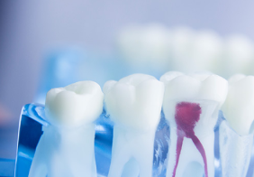 精密さを極める治療