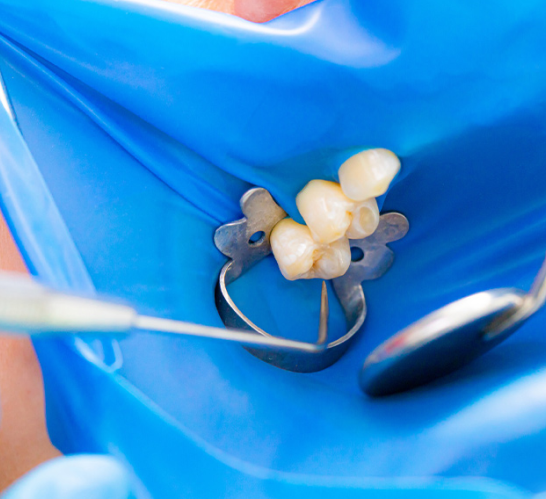 徹底した無菌環境の維持