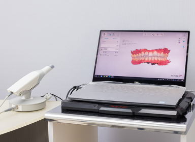 口腔内スキャナ