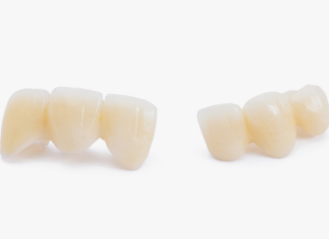 審美性に優れた治療にも